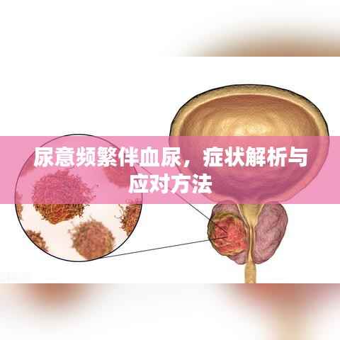 尿意频繁伴血尿,症状解析与应对方法